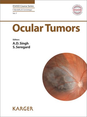 cover image of Ocular Tumors